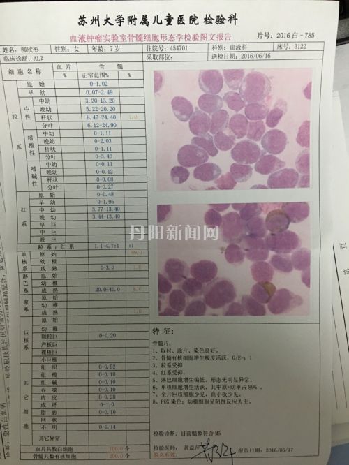 欣彤的检验报告
